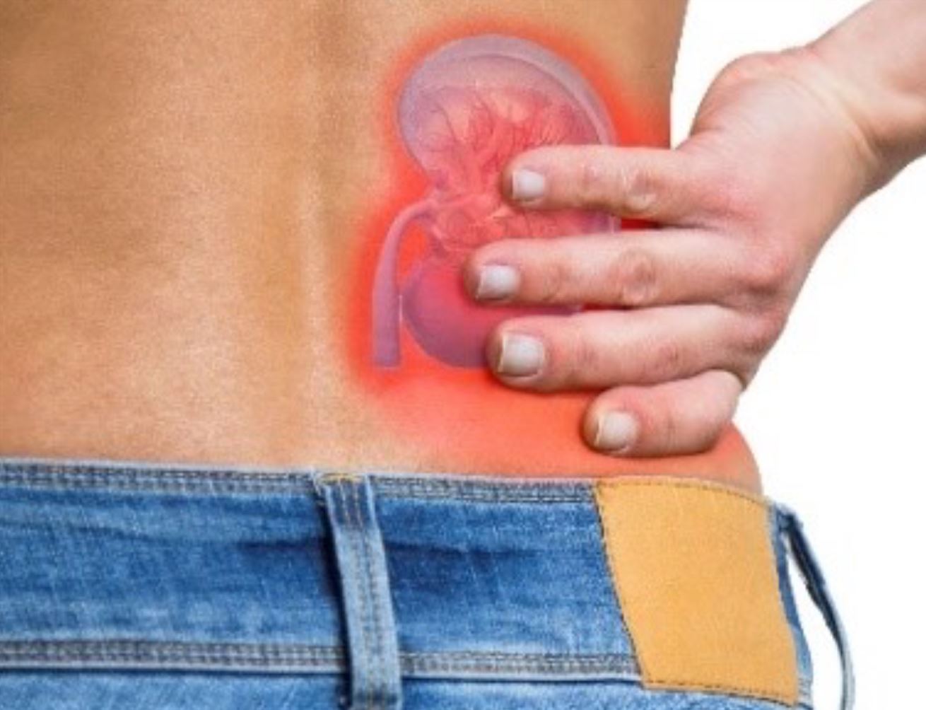 Kidney cancer awareness month